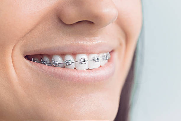 Best Invisalign and Clear Aligners  in Chatsworth, IL